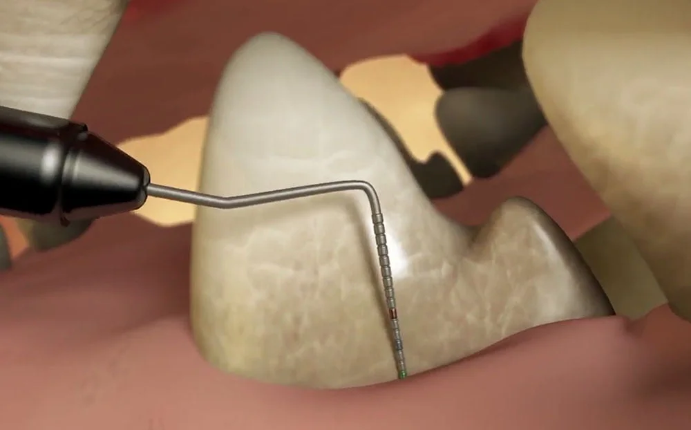 Atividade Física: Restrições e Retorno Gradual - inspiração 2