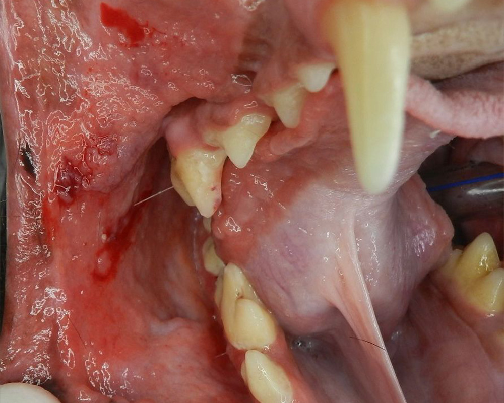 Outras doenças sistêmicas que causam mau hálito - inspiração 1