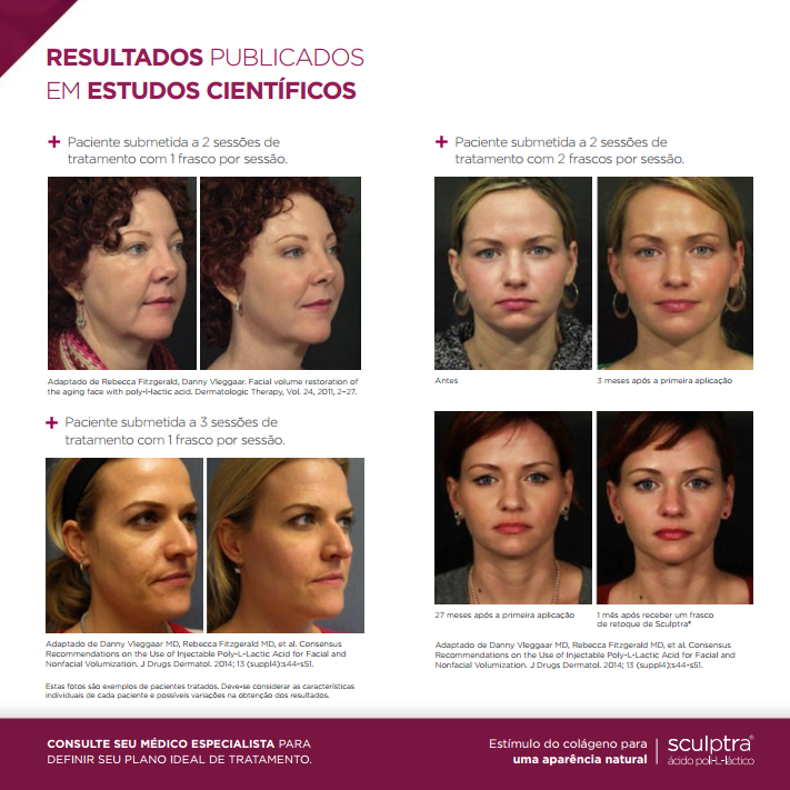 ácido poli-L-láctico sculptra como age