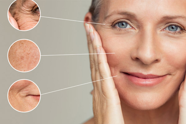 melhores resultados sculptra antes e depois