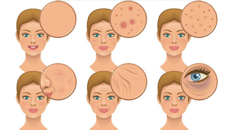 Exames para Diagnosticar Problemas com Glúten: O Que Esperar?