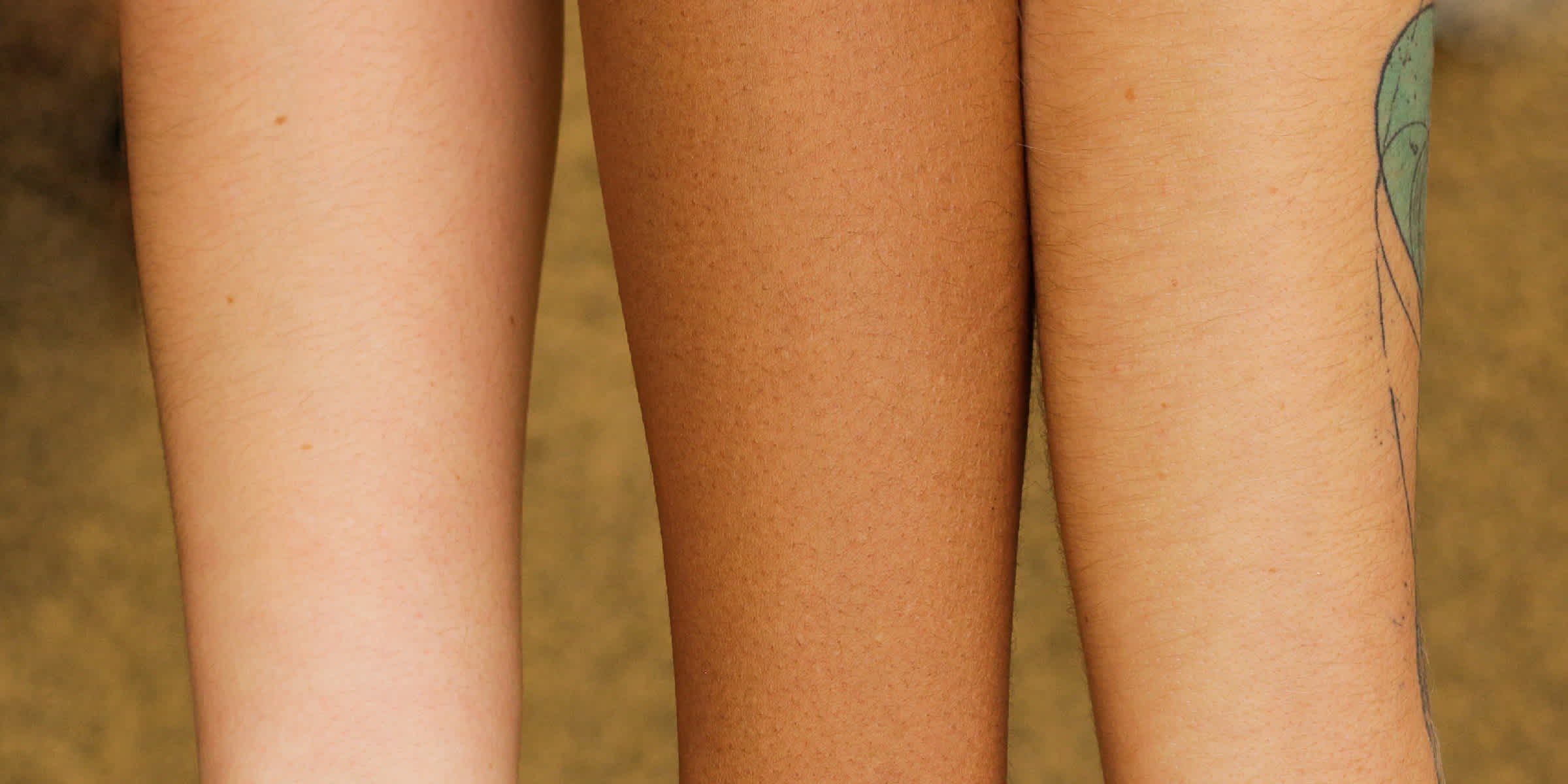 Anticoncepcional Para Pele Oleosa