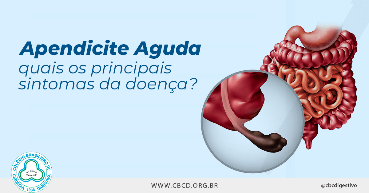 1. Apendicite: Quando a Diarreia é um Sinal de Alerta
2. Entendendo a Relação Entre Apendicite e Problemas Intestinais
3. Os Sintomas Clássicos da Apendicite que Você Não Pode Ignorar
4. Apendicite Crônica: Um Olhar Sobre Causas e Sintomas Incomuns
5. Dor Abdominal e Diarreia: Sinais de Alerta para Apendicite
