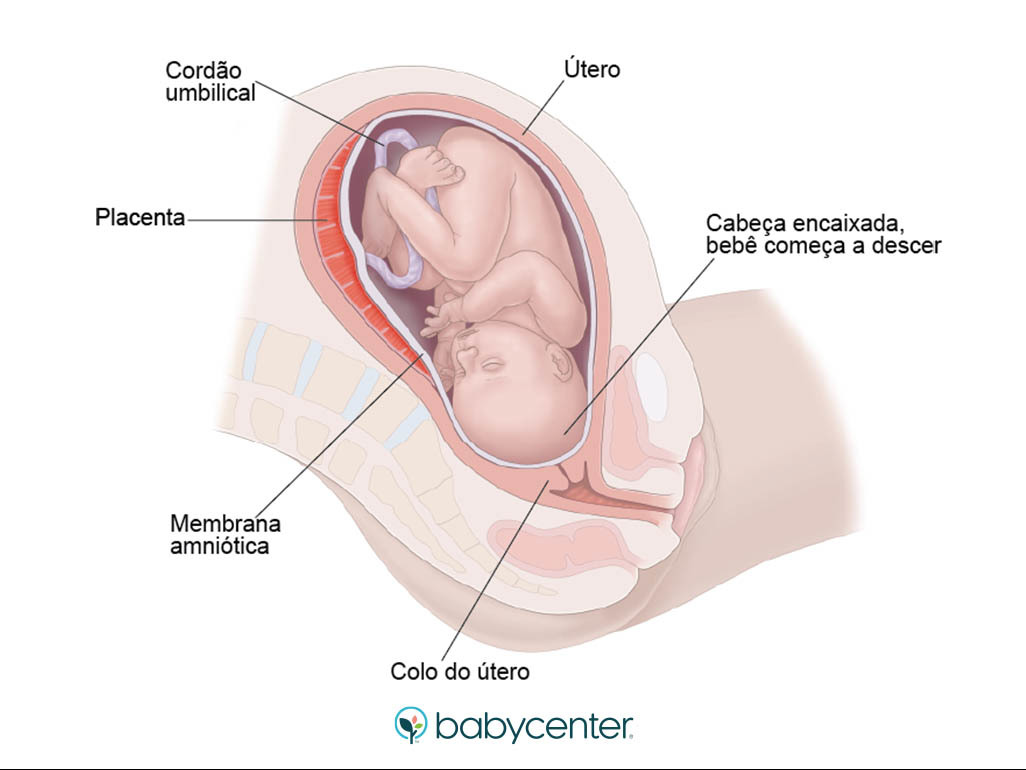 Bebe Encaixado Com 34 Semanas