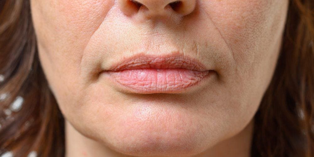 causas do bigode chinês em jovens