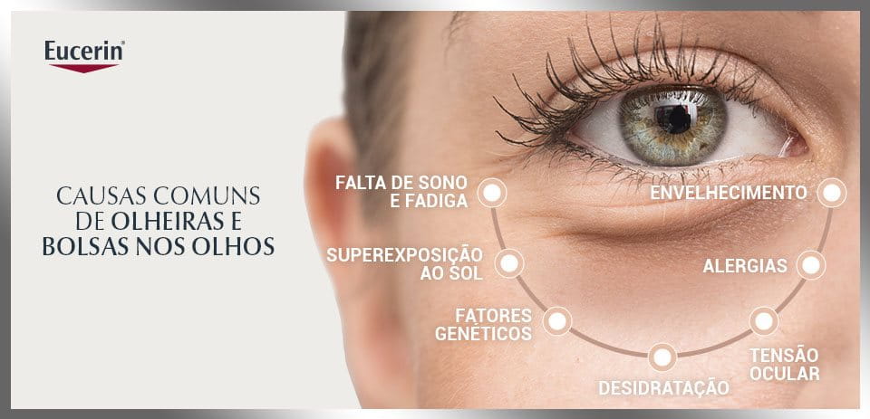 Como Prevenir Bolsas nos Olhos: Dicas Essenciais de Hábitos e Cuidados