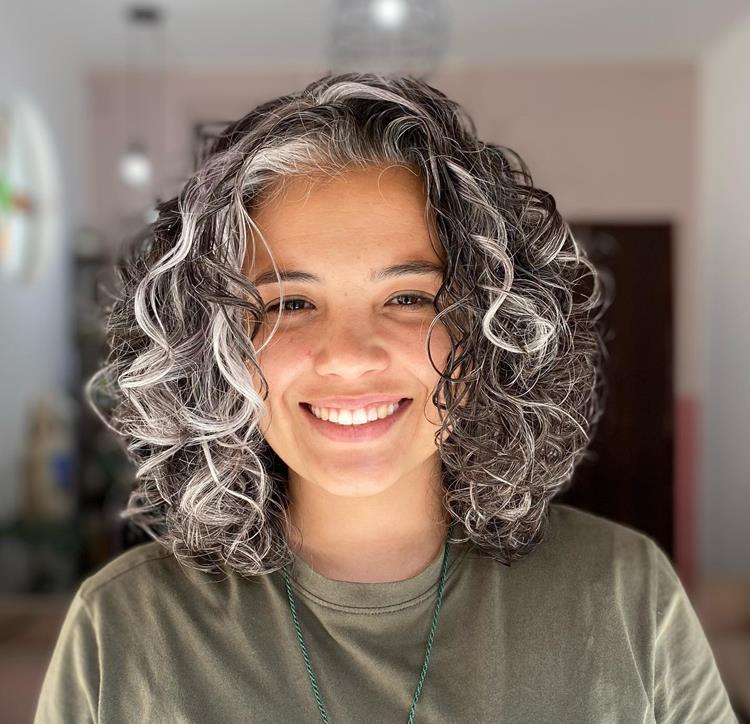 cabelo branco aos 20 anos