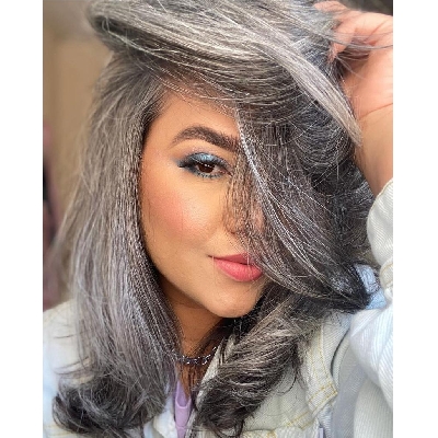 cabelo branco aos 20 anos