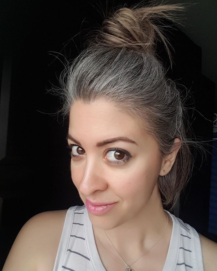 cabelo branco aos 20 anos
