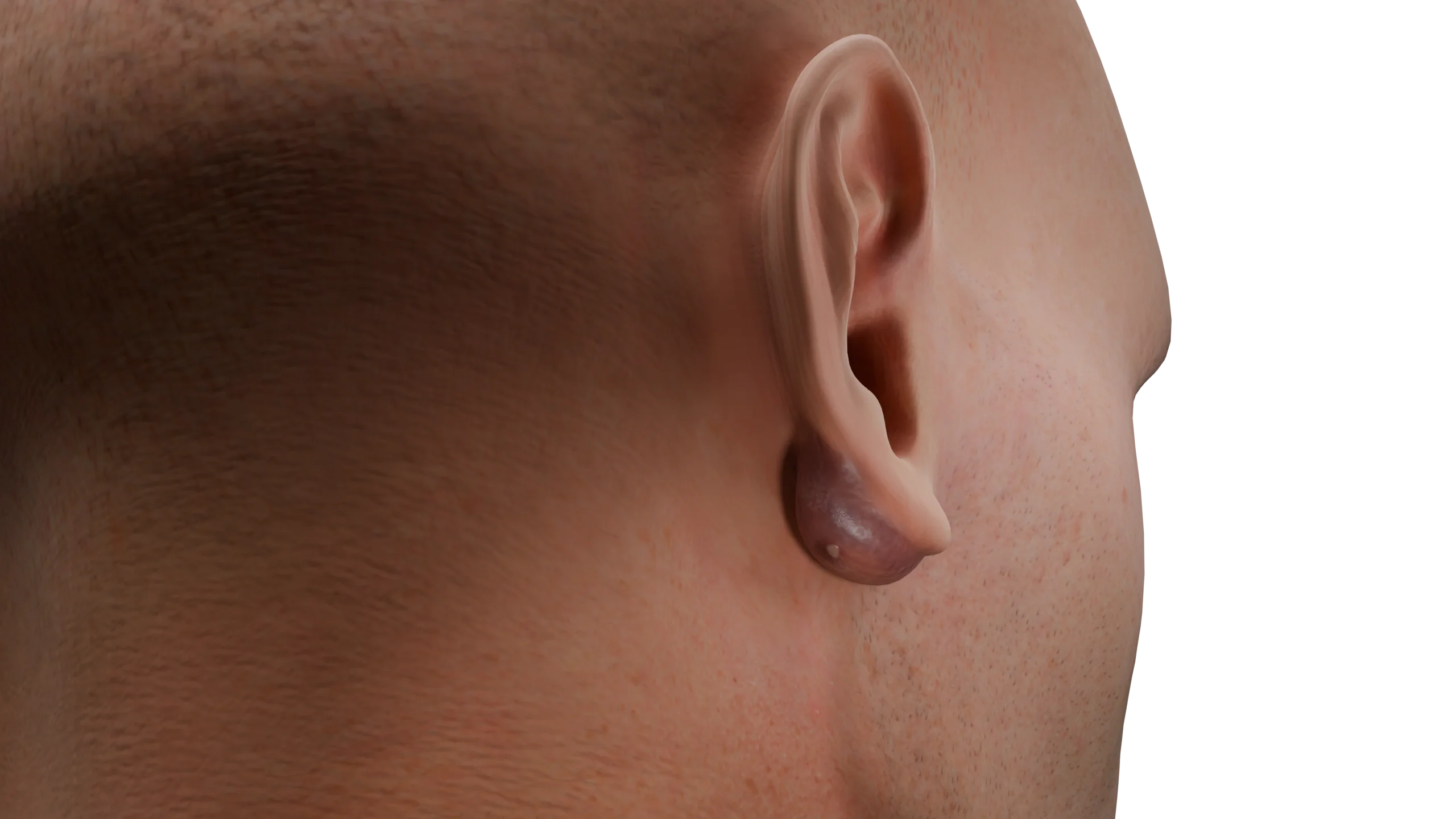 5 ideias de títulos:
1. Câncer de Ouvido: Sinais de Alerta que Você Não Pode Ignorar
2. Entendendo os Tipos de Tumores no Ouvido: Benignos e Malignos
3. Diagnóstico Precoce do Câncer de Orelha: A Importância da Ressonância Magnética
4. Prevenção do Câncer de Ouvido: Fatores de Risco e Cuidados Essenciais
5. O Que Fazer ao Identificar Sintomas de Câncer no Ouvido: Guia Completo