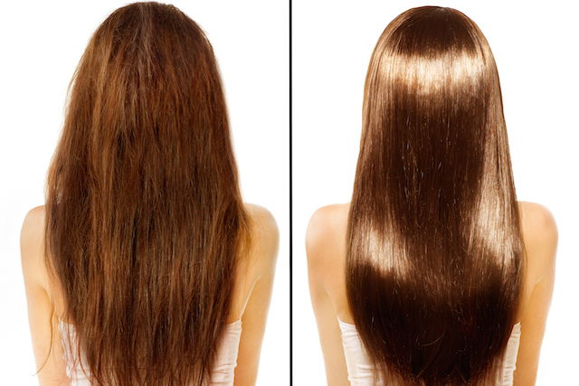 Cauterização Capilar