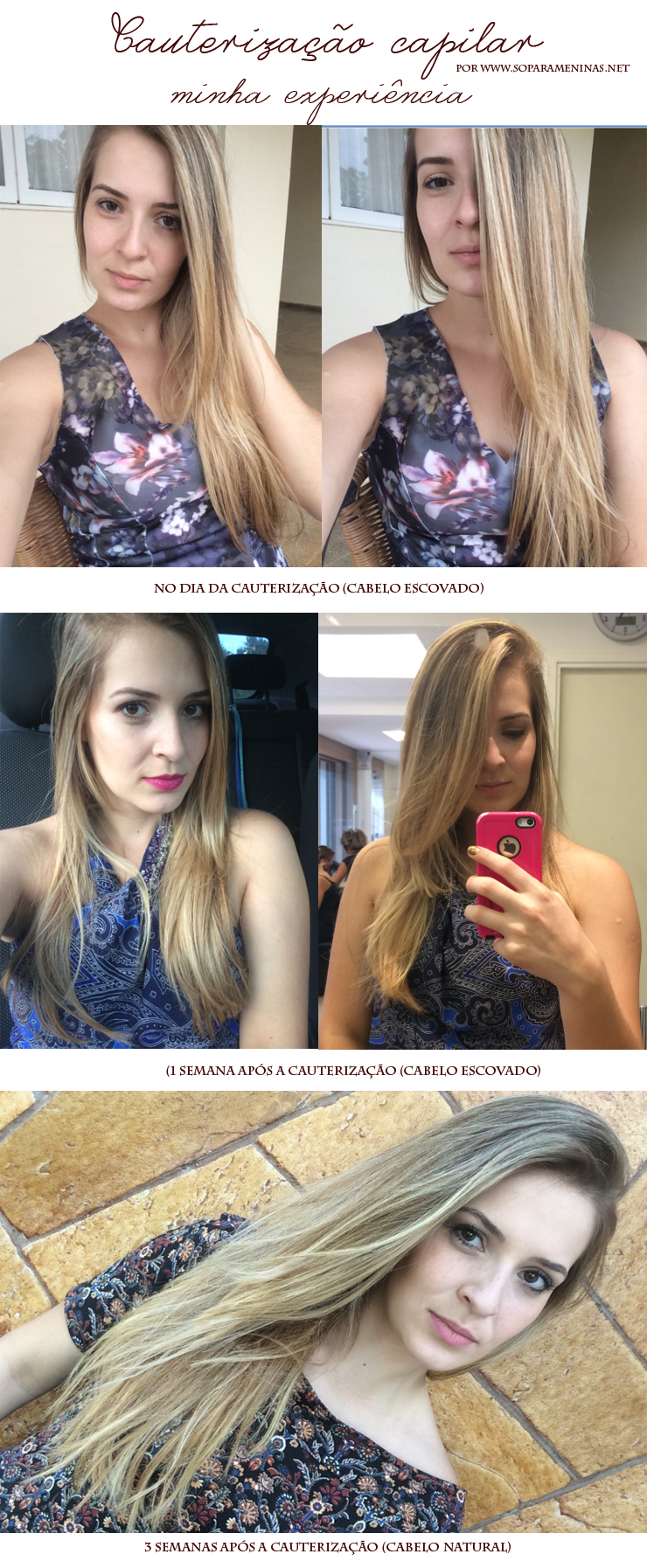 5 ideias de títulos:
1. Cauterização Capilar: O Guia Completo para Cabelos Saudáveis
2. Passo a Passo da Cauterização Capilar: Faça em Casa ou no Salão
3. Cauterização vs. Hidratação vs. Nutrição: Qual a Melhor para Seu Cabelo?
4. Quem Pode Fazer Cauterização Capilar? Indicações e Frequência Ideal
5. Marcas de Cauterização Capilar: As Melhores Opções do Mercado