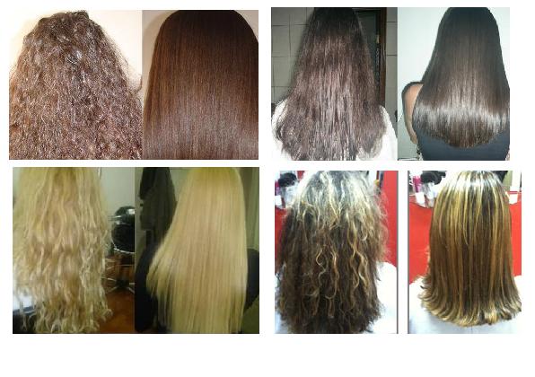 Cauterização Capilar