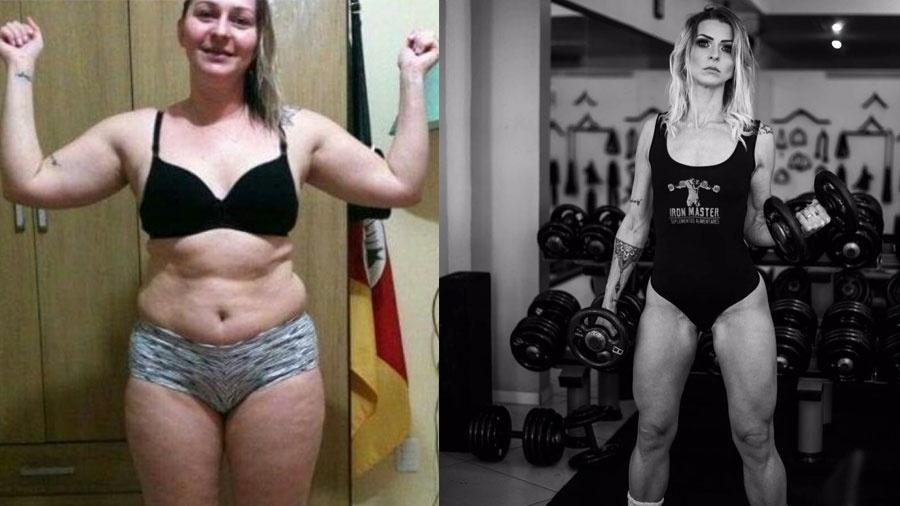 Celulite Como Diminuir