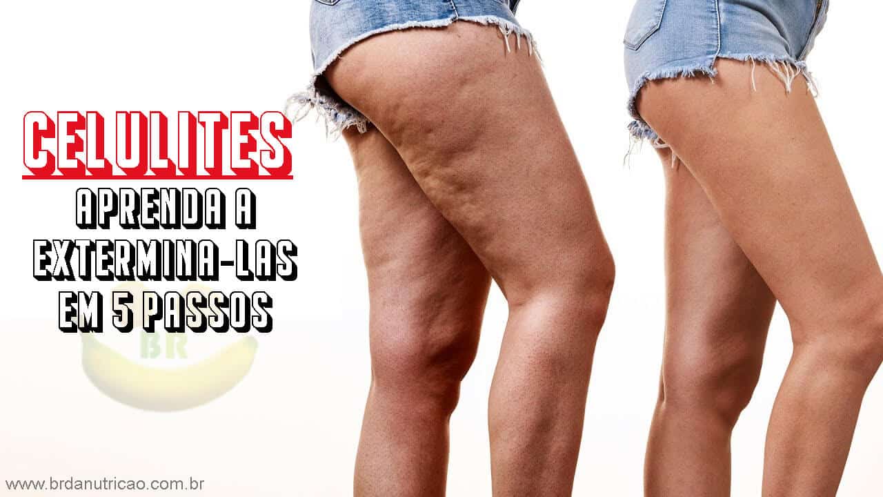 Celulite Como Diminuir