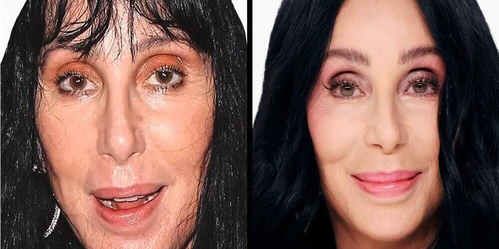 Cirurgia Plastica Gratuita