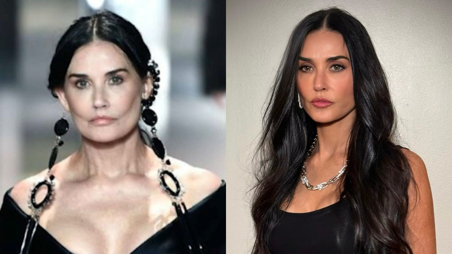 Projetos Sociais que Democratizam o Acesso à Cirurgia Plástica