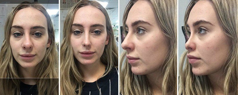 Cirurgia Plastica Gratuita