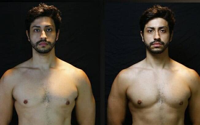 Guia Completo: Como Conseguir Cirurgia Plástica Gratuita pelo SUS