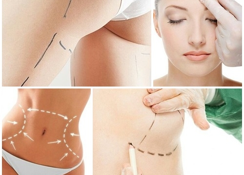 Documentação Necessária para Solicitar Cirurgia Plástica Gratuita no SUS