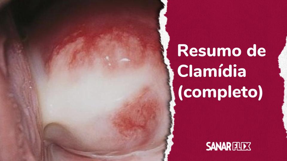 Guia completo sobre ISTs: Prevenção e Tratamento
