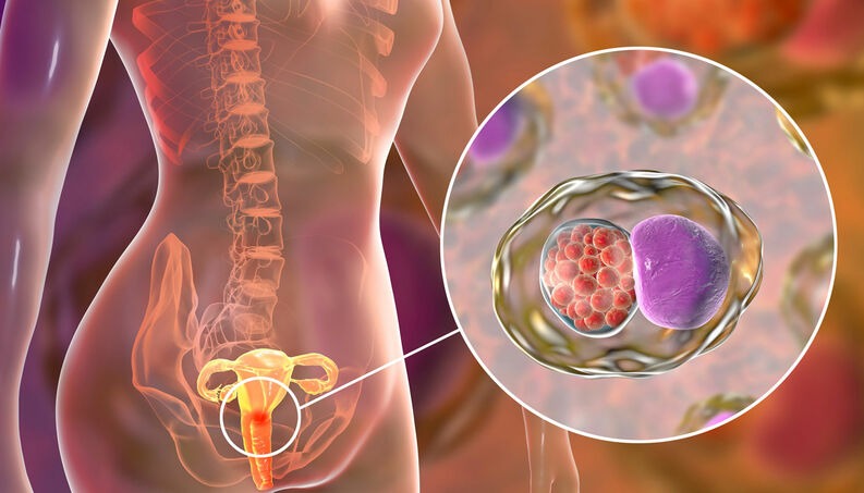 Clamídia em mulheres: Sintomas