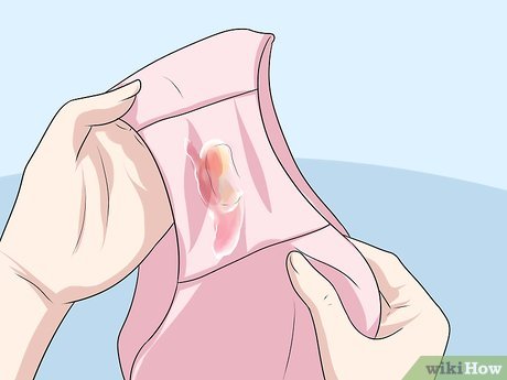 A importância do tratamento do parceiro na clamídia