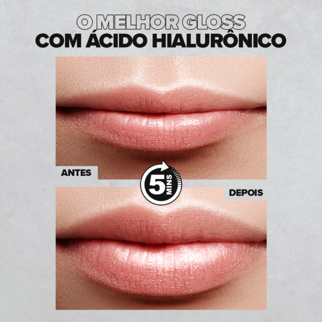 Os Melhores Exercícios Faciais para Aumentar o Volume dos Lábios a Longo Prazo