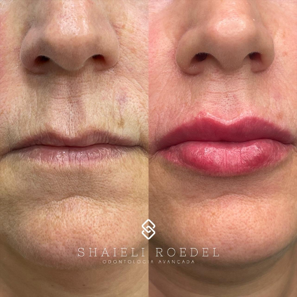 Receitas Caseiras para Lábios Mais Cheios e Hidratados