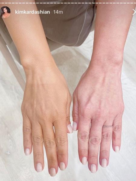 5 ideias de títulos:
1. Guia Completo: Como Conseguir uma Pele Mais Clara e Uniforme
2. Truques de Maquiagem para um Efeito Pele Pálida Instantâneo
3. Os Melhores Ativos Clareadores para sua Rotina de Skincare
4. Dicas de Estilo para Realçar a Palidez Natural da Pele
5. Cuidados Essenciais para Manter a Pele Clara e Protegida