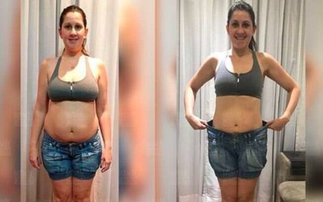 Como Perder A Barriga Depois Da Cesariana