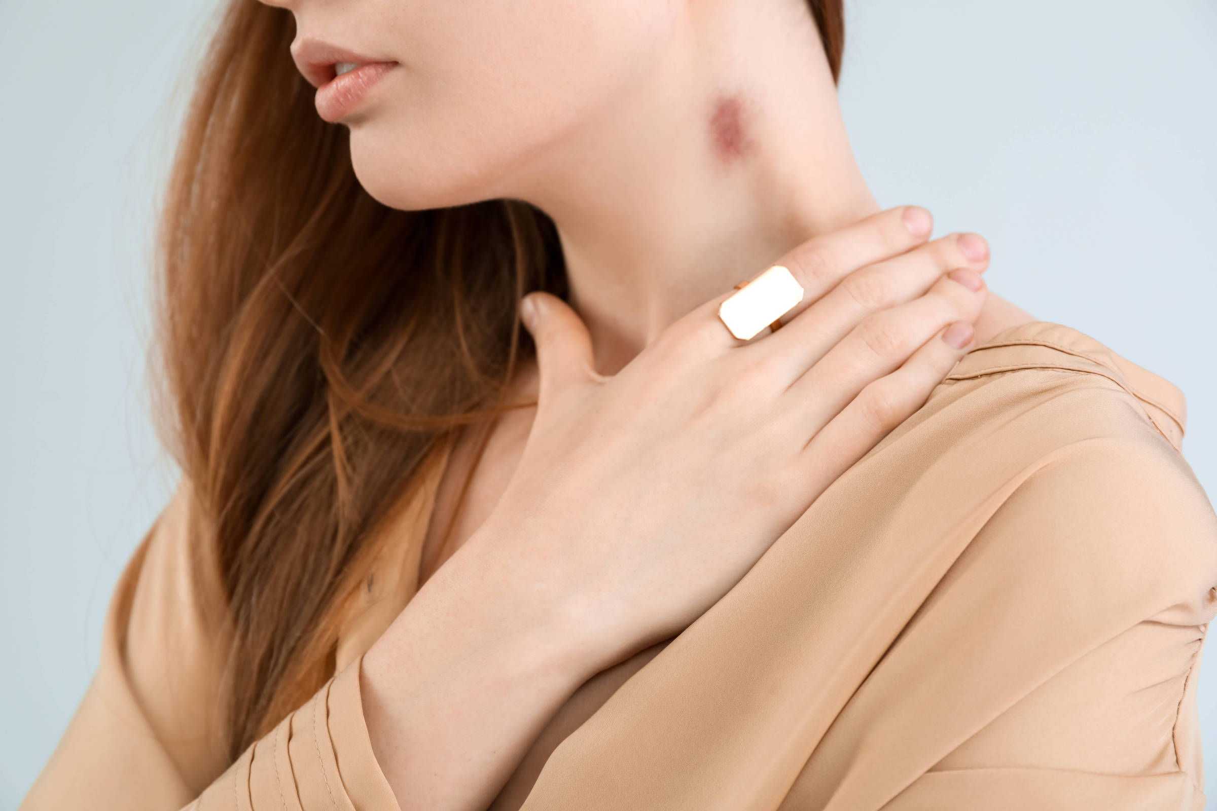 erros comuns ao tentar tirar chupão com gelo