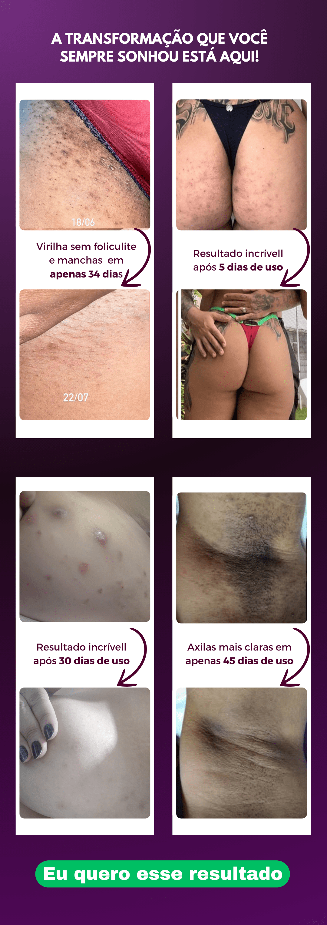 Como Tirar Manchas De Foliculite