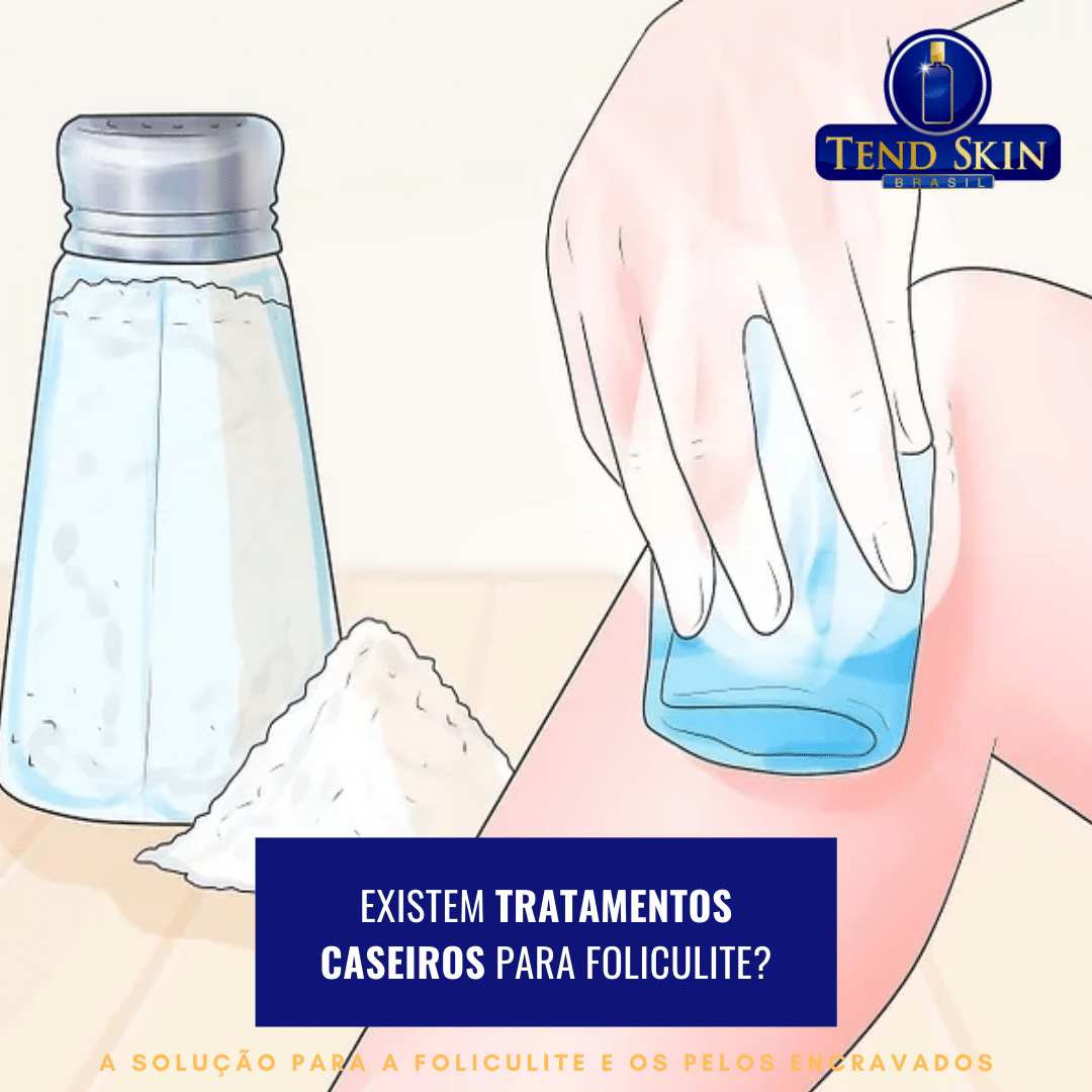 5 ideias de títulos:
1. Foliculite: Guia Completo de Tratamento e Clareamento de Manchas
2. Os Melhores Ativos e Procedimentos para Dizer Adeus às Manchas de Foliculite
3. Prevenção e Cuidados Diários: Como Evitar o Retorno da Foliculite e Suas Manchas
4. Foliculite: Do Controle da Inflamação ao Clareamento da Pele
5. Mitos e Verdades sobre o Tratamento de Manchas de Foliculite
