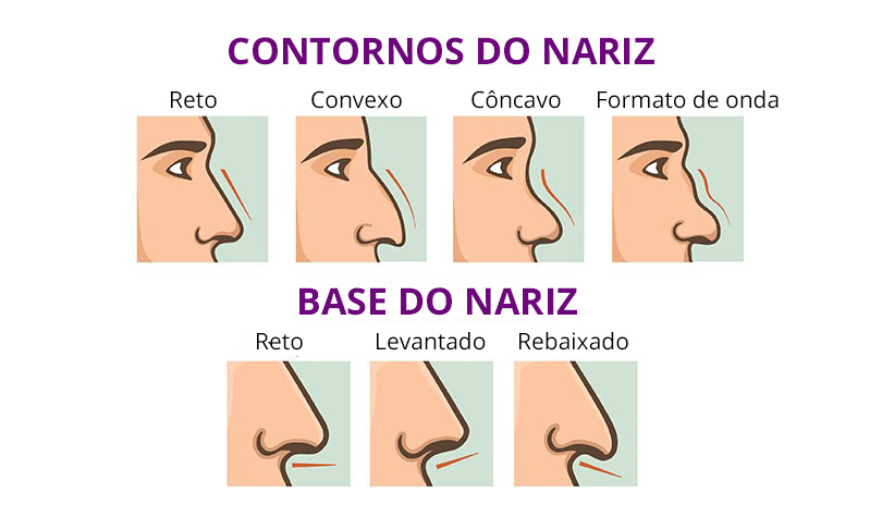 Como Evitar Erros Comuns no Contorno de Nariz e Ter um Resultado Natural