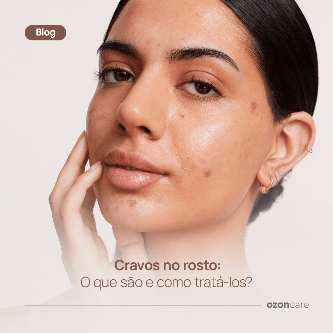Limpeza de Pele Profissional vs. Caseira: Qual a Melhor Opção para Cravos?