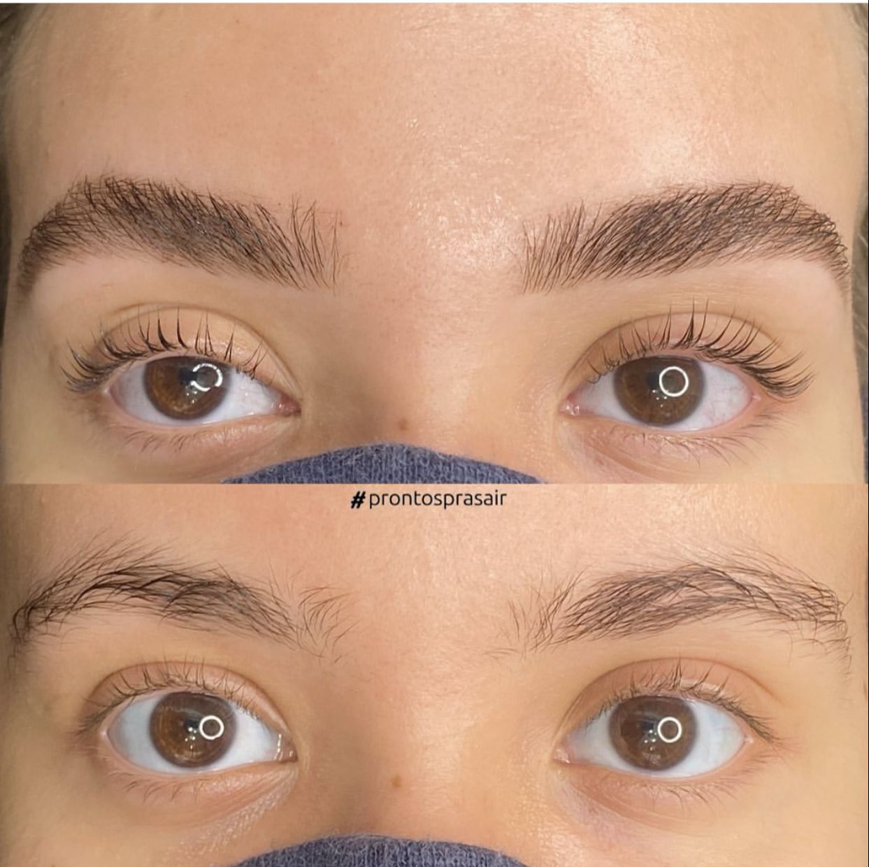 Biotina e Fatores de Crescimento: O Papel Essencial na Saúde e Volume das Sobrancelhas