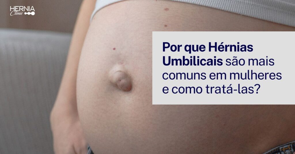 Tapar o Umbigo: Entenda a Crença e Seus Mitos