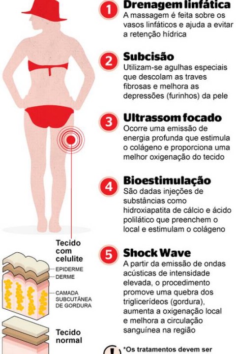 Rotina de Exercícios em Casa para Combater a Celulite