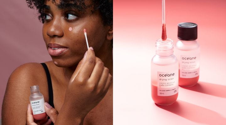 Dicas Para Secar Espinhas