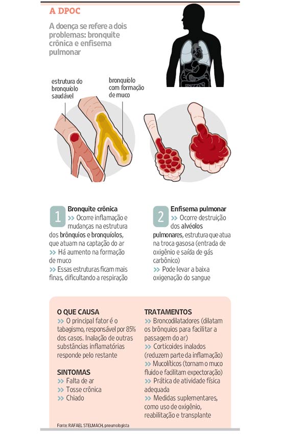 1. Dieta Mediterrânea e Saúde Pulmonar: Benefícios Comprovados.
2. Proteínas Essenciais: Como Fortalecer os Músculos Respiratórios.
3. Carboidratos vs. Gorduras Saudáveis: Qual a Melhor Opção para DPOC?
4. A Importância da Hidratação na Limpeza Pulmonar.
5. Dicas Práticas: Refeições Pequenas e Frequentes para Facilitar a Respiração.