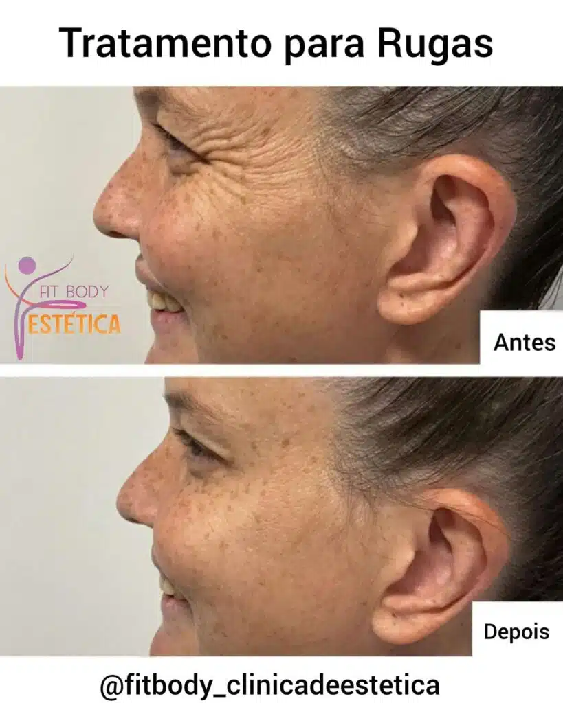 Os Hábitos Diários Essenciais para uma Pele Sem Rugas