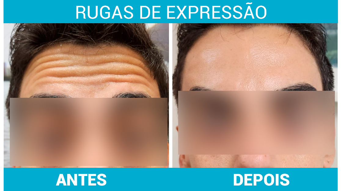 Alimentação e Hidratação: O Segredo para Prevenir o Envelhecimento Precoce