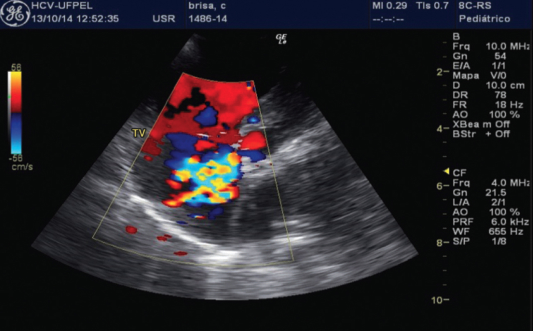 raças de cães com predisposição a problemas cardíacos