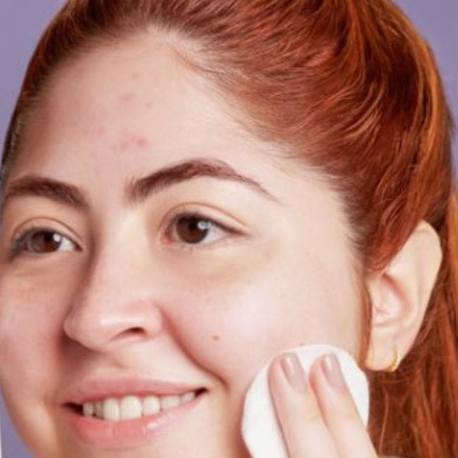 Como o estresse afeta a pele e causa espinhas na testa?