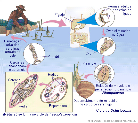 Diferenças entre fase aguda e crônica da esquistossomose: o que você precisa saber