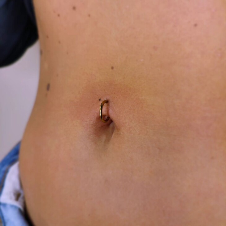 sinais de piercing no umbigo cicatrizado