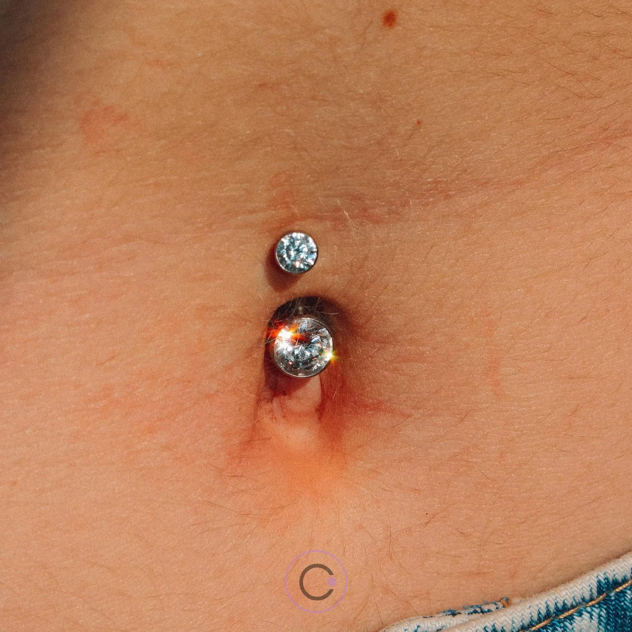sinais de piercing no umbigo cicatrizado