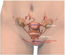 Flato Vaginal: O Que É, Causas e Quando Se Preocupar