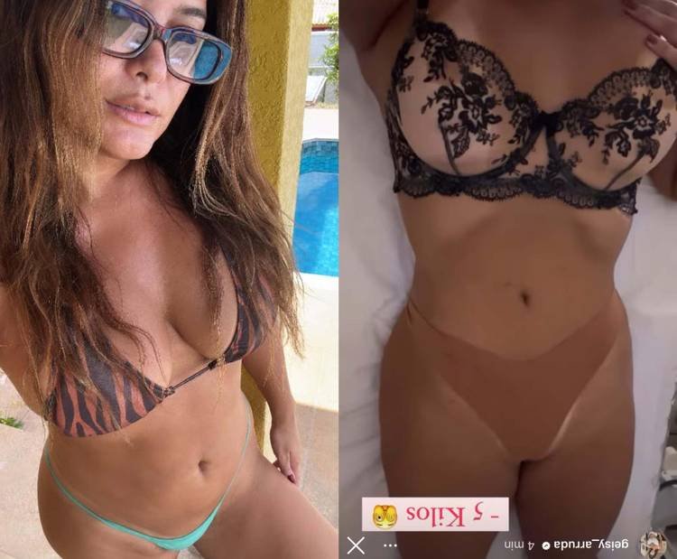 Estética facial de Geisy Arruda: Facetas